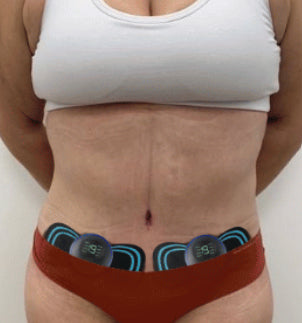 PelviMed™ | Genvind kontrollen på kun 15 minutter om dagen