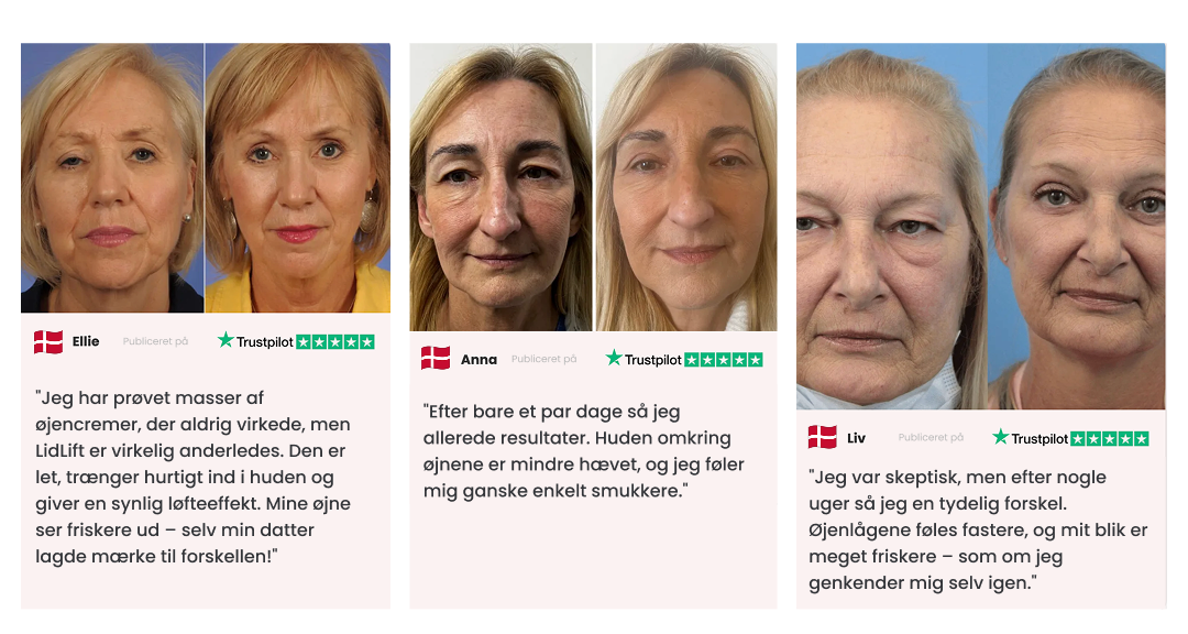 LiftLid™ | Løft hængende øjenlåg – uden Botox eller kirurgi