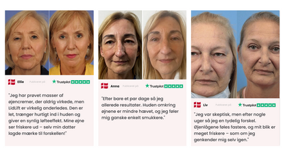 LiftLid™ | Løft hængende øjenlåg – uden Botox eller kirurgi