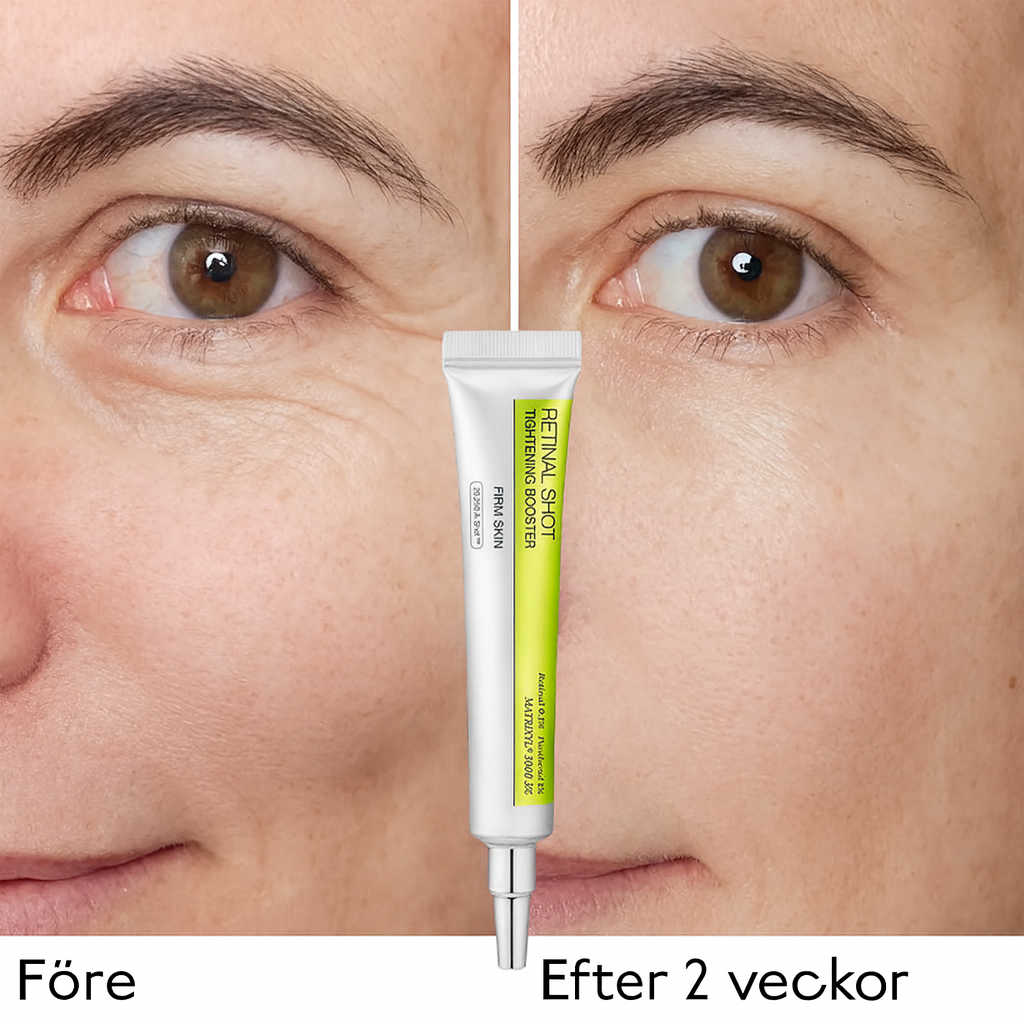 LiftShot™ | Udglat fine linjer – genopliv den sarte hud under øjnene