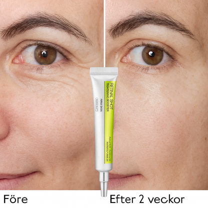 LiftShot™ | Udglat fine linjer – genopliv den sarte hud under øjnene