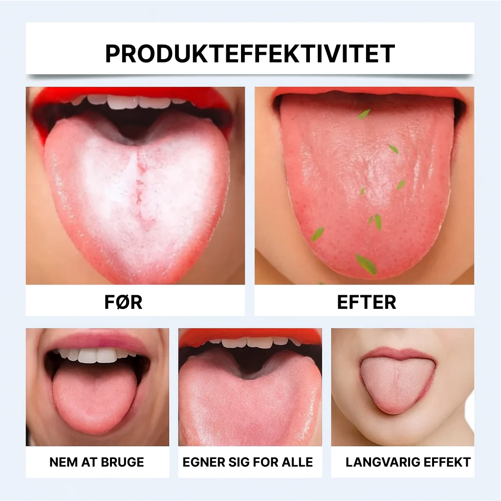 OralFresh™ | Sig farvel til belægninger på tungen, dårlig ånde og bakterier