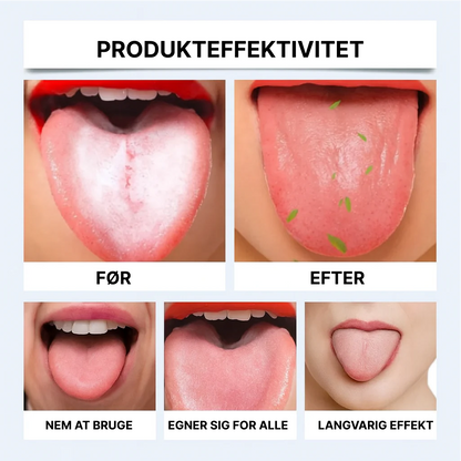 OralFresh™ | Sig farvel til belægninger på tungen, dårlig ånde og bakterier