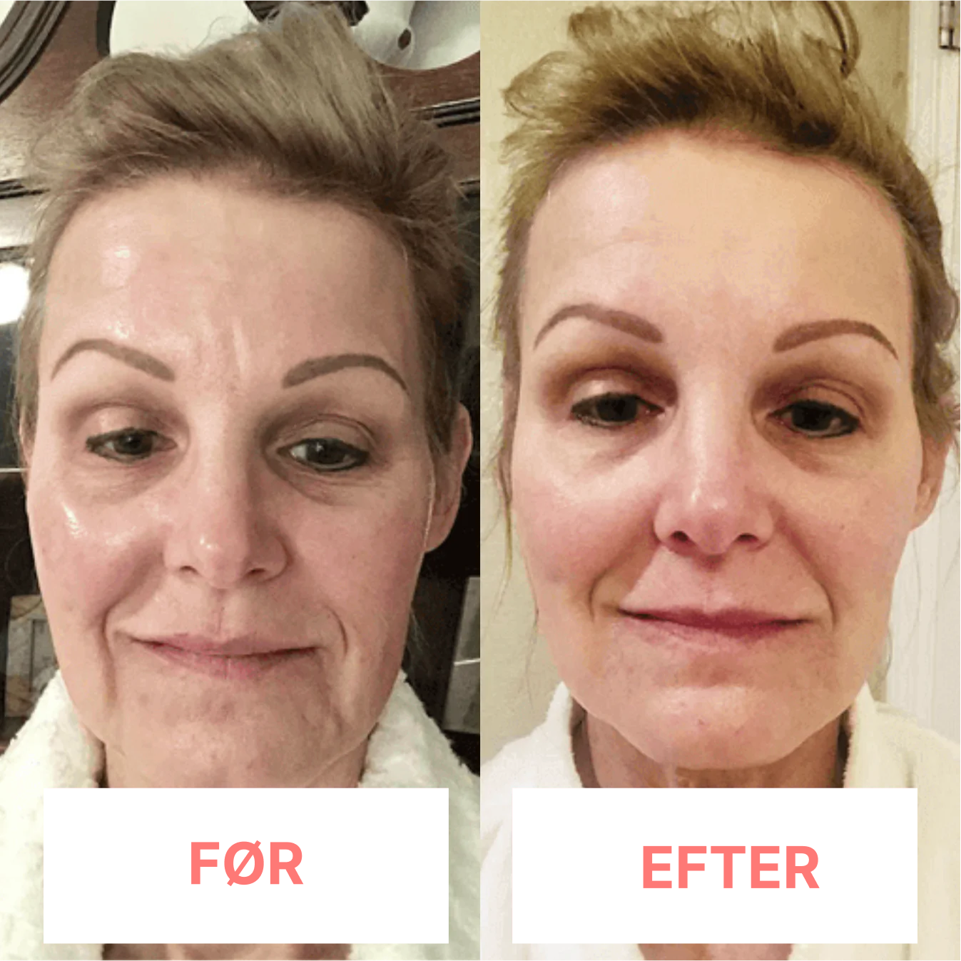 DermaTone™ – Tone, Sculpt, and Smooth