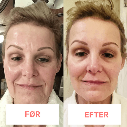 DermaTone™ – Tone, Sculpt, and Smooth