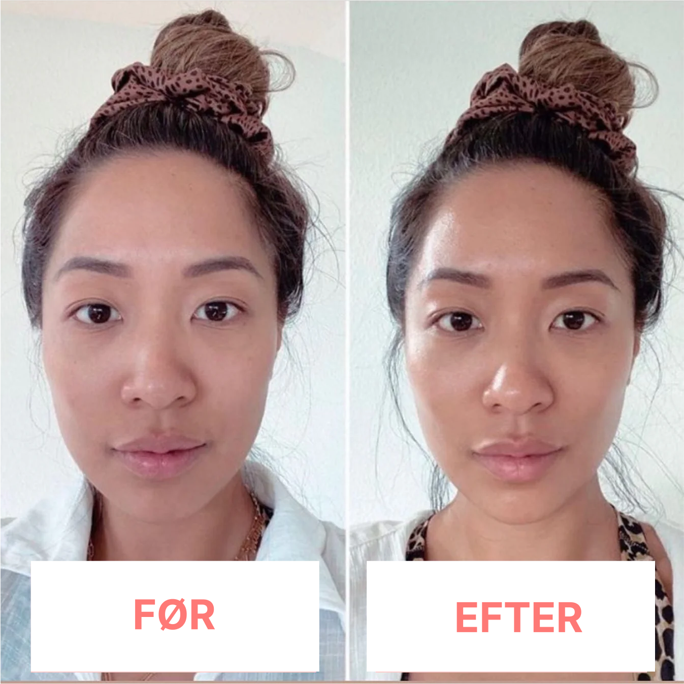 DermaTone™ – Tone, Sculpt, and Smooth