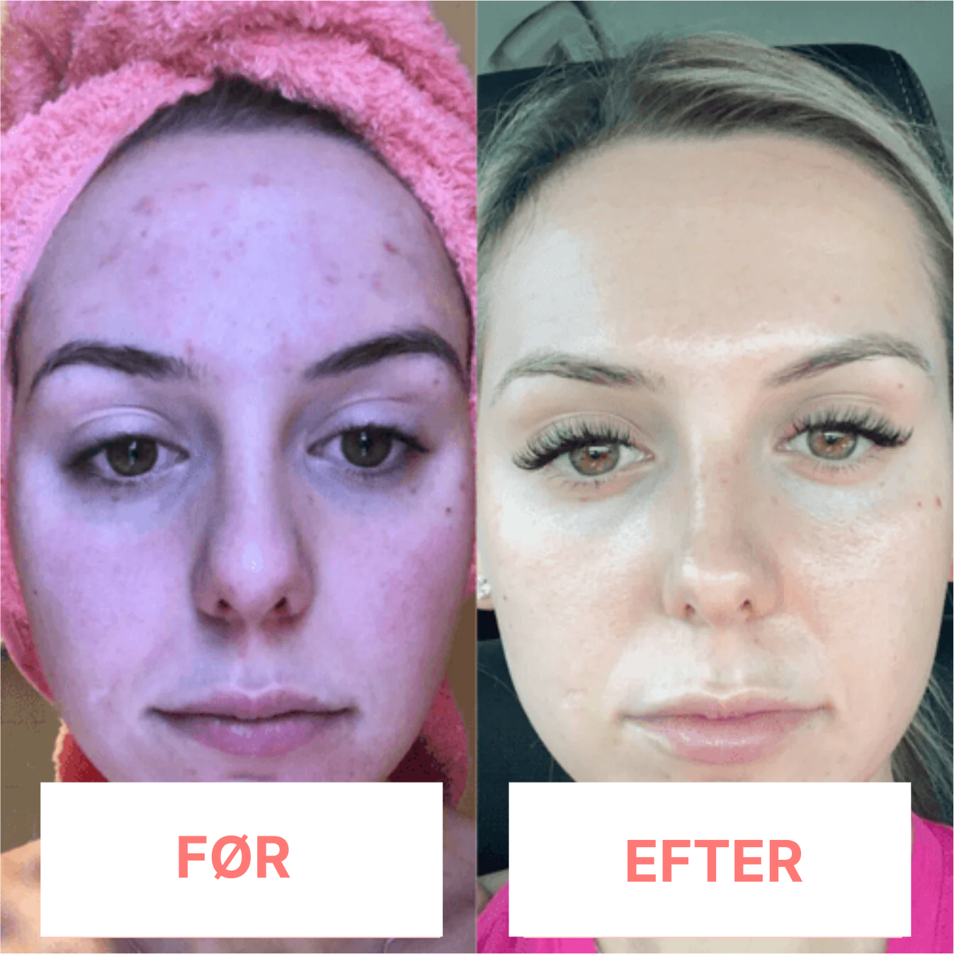 DermaTone™ – Tone, Sculpt, and Smooth