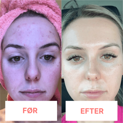 DermaTone™ – Tone, Sculpt, and Smooth