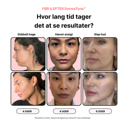 DermaTone™ – Tone, Sculpt, and Smooth