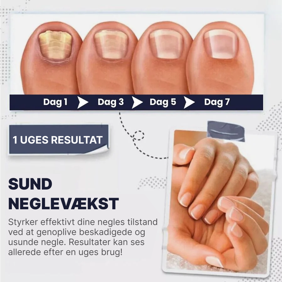 NailArmor™ | Få stærkere og sundere negle på kun 7 dage