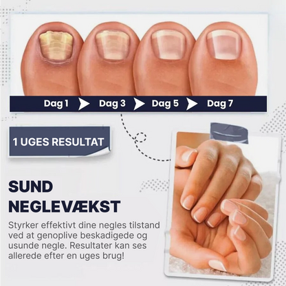 NailArmor™ | Få stærkere og sundere negle på kun 7 dage