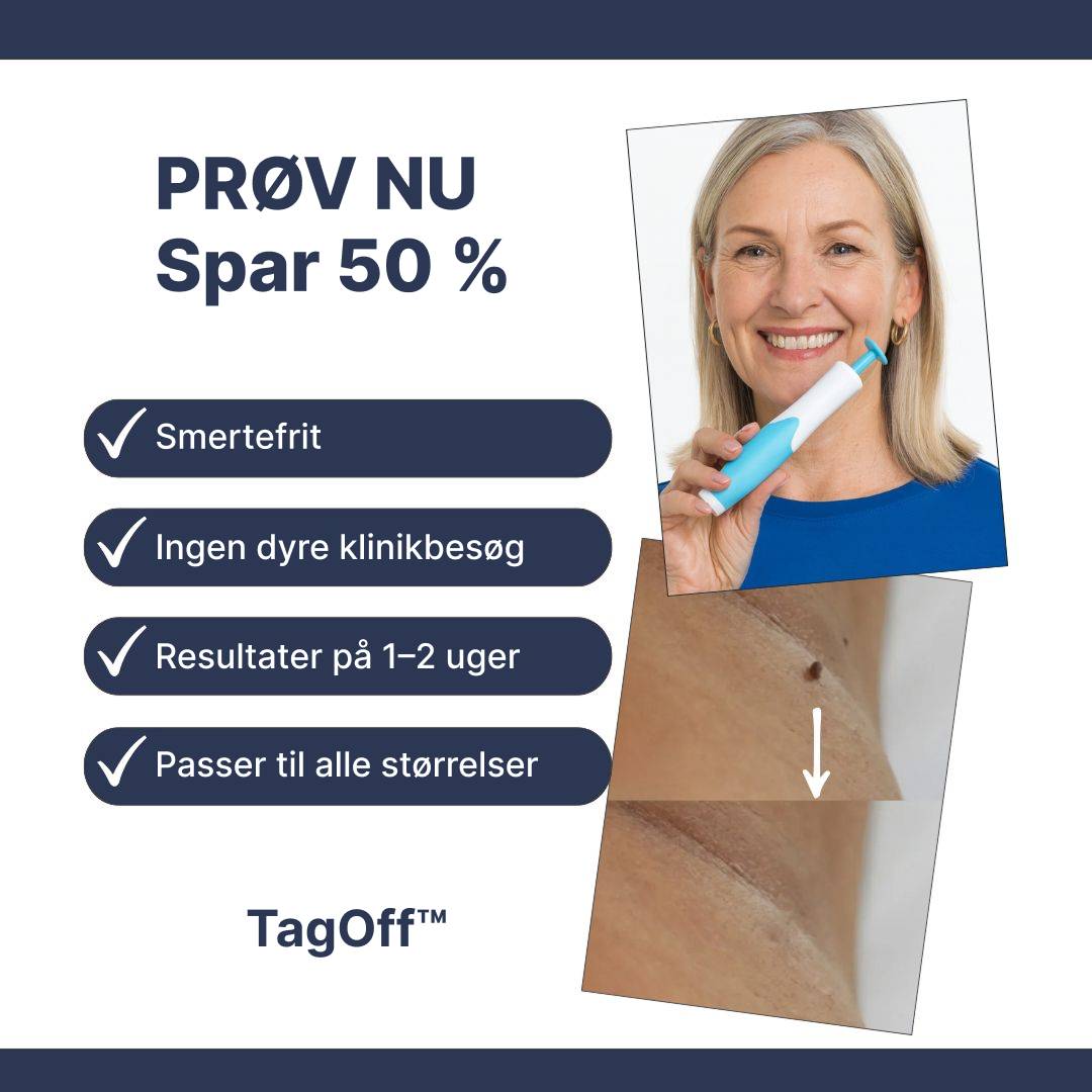TagOff™ | Enkel og naturlig fjernelse derhjemme (1–2 uger)