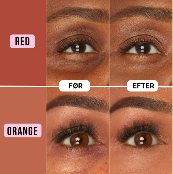 BeGone™ Undereye Concealer