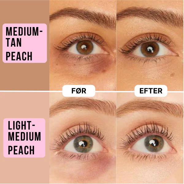 BeGone™ Undereye Concealer