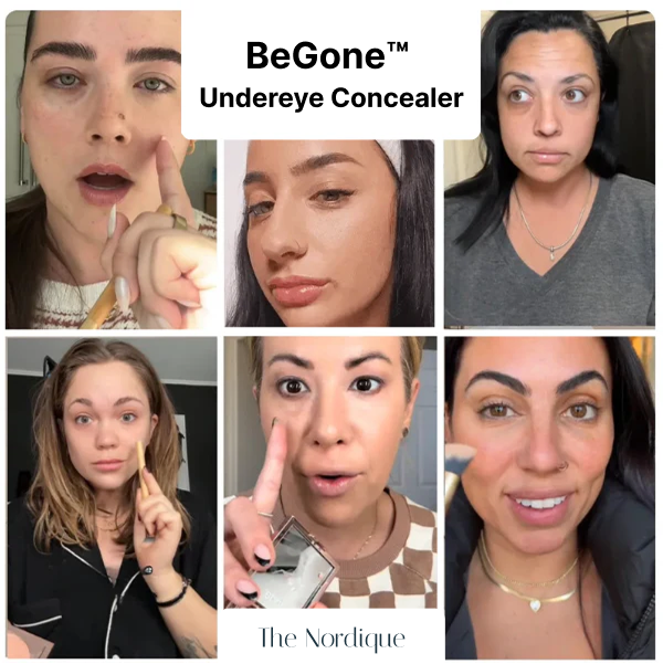 BeGone™ Undereye Concealer