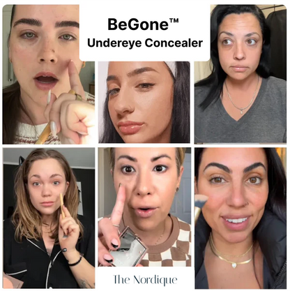 BeGone™ Undereye Concealer