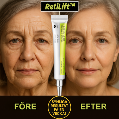 LiftShot™ | Udglat fine linjer – genopliv den sarte hud under øjnene